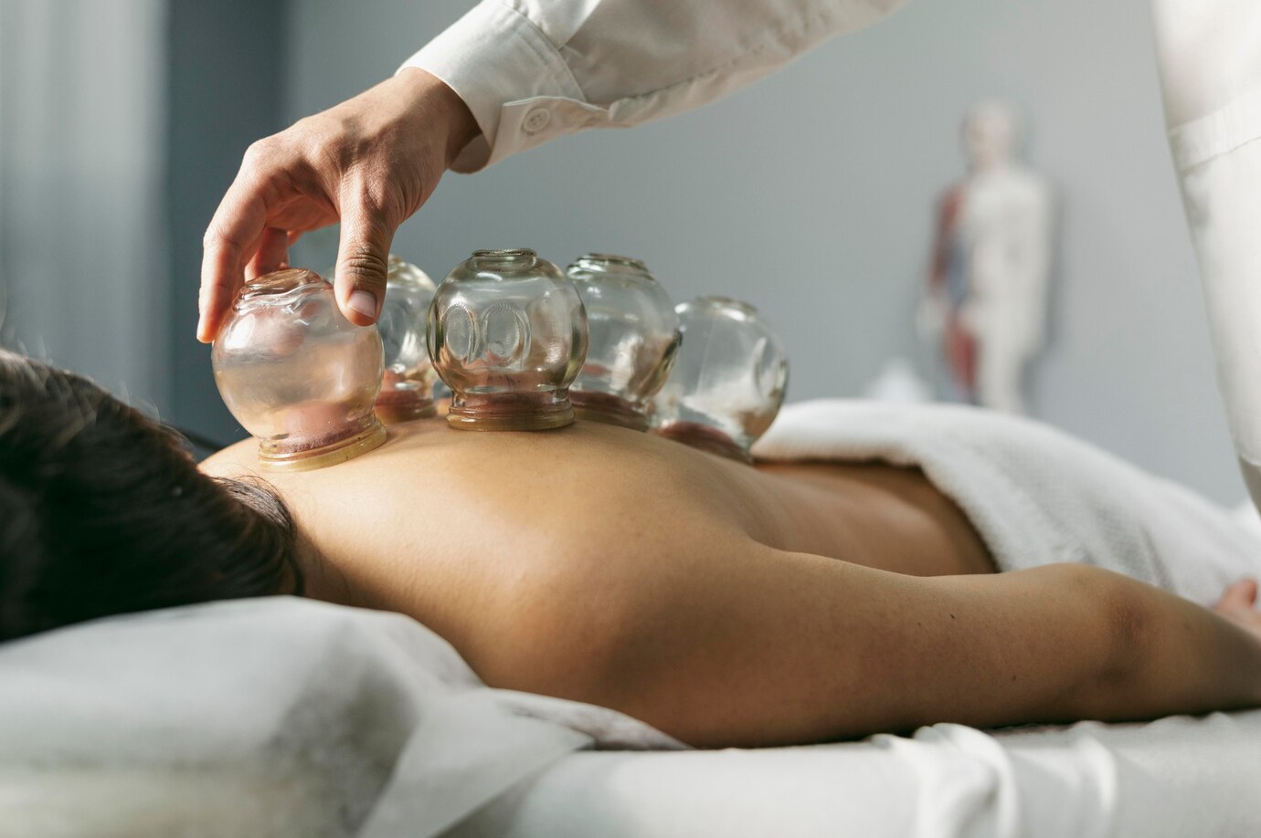 Hijama Cupping