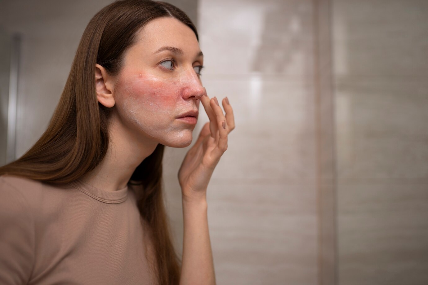 Skin conditions