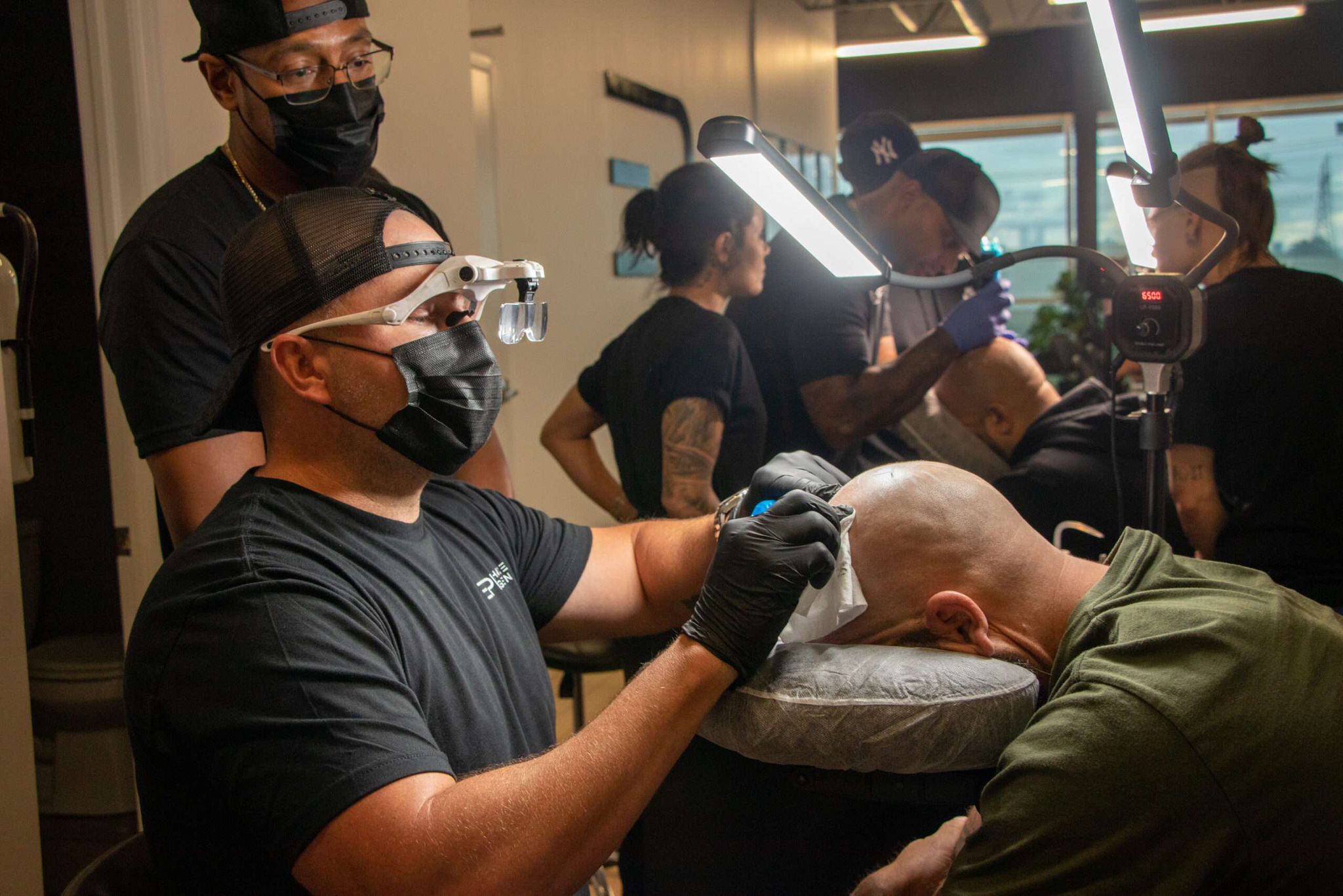 Scalp Micropigmentation